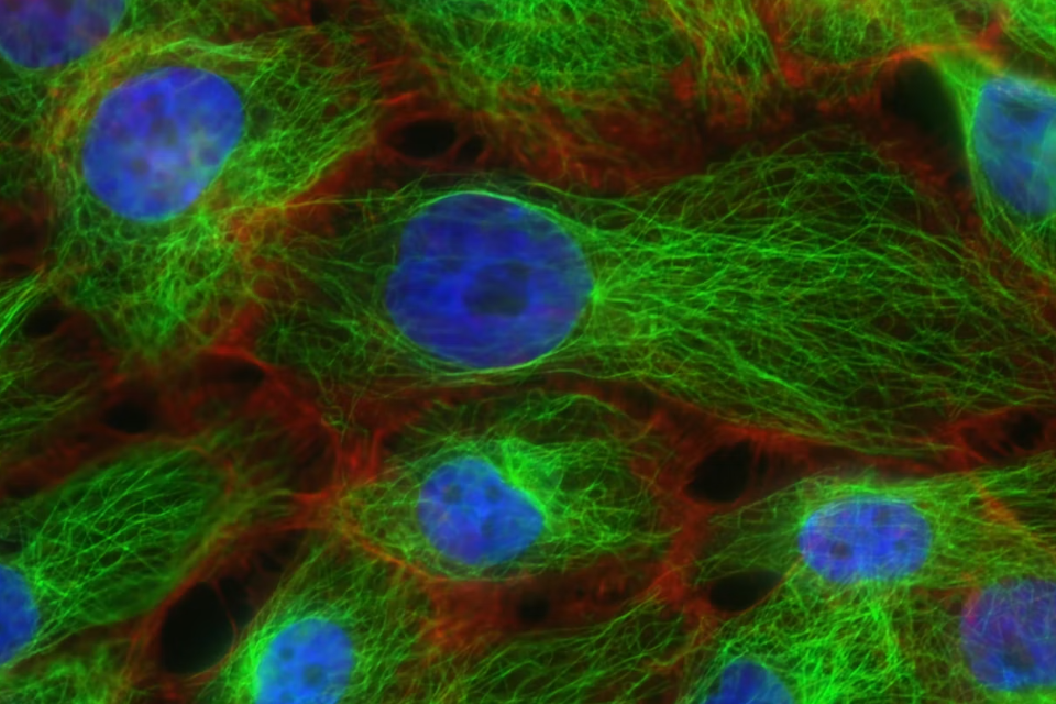 Contoh Soal Biologi tentang Sel dan Jawabannya Lengkap untuk Bahan Belajar